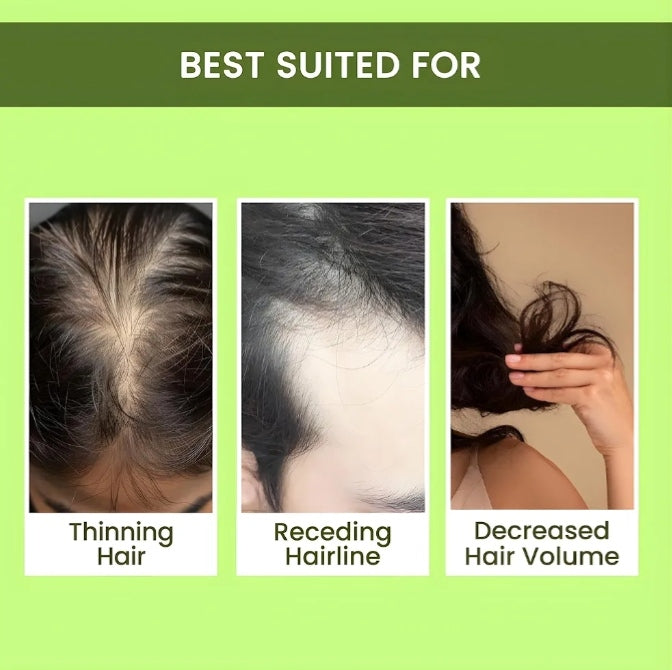 Rosemary Water, Hair Spray For Regrowth Buy 1 Get 2 Free